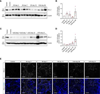 Variable Expression of Programmed Cell Death Protein 1-Ligand 1 in Kidneys Independent of Immune Checkpoint Inhibition